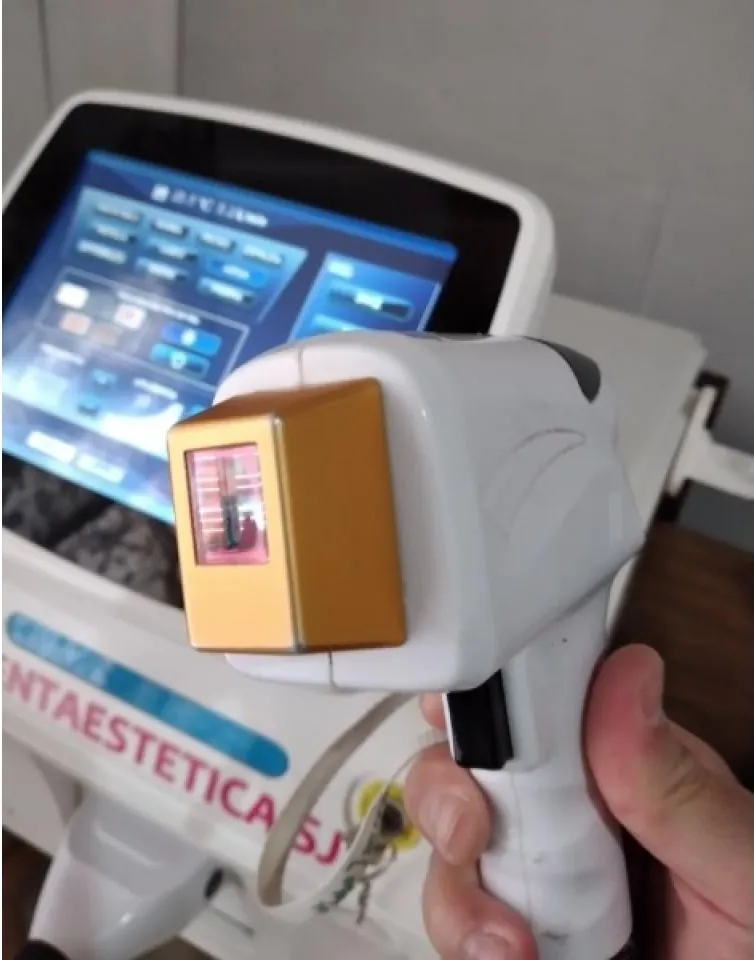 Alquiler Depiladora Laser Definitiva Foto Rejuvenecimiento, Exilis 360 Btl, Hifu22d · foto 3